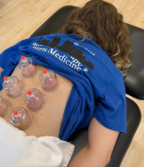 Cupping