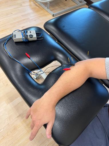 Dry Needling